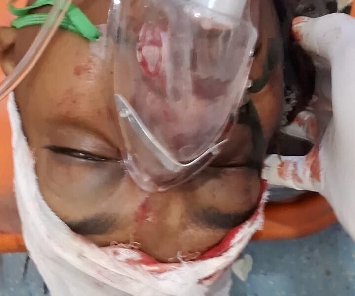 વઘાસિયા નજીક કારખાનામાં અકસ્માત: ૧૦૮ ટીમની તાત્કાલિક કામગીરીથી યુવાનનો જીવ બચ્યો